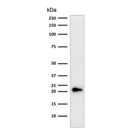 Western blot testing of human HeLa cell lysate with p21 antibody cocktail (clones CIP1/823 + DCS-60.
