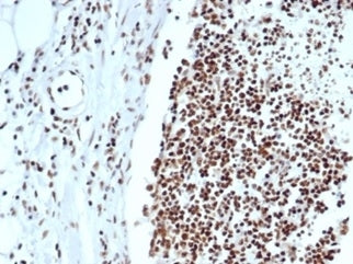 IHC staining of FFPE human lymph node with XRCC5 antibody (clone XRCC5/7318). HIER: boil tissue sect