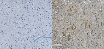 IHC staining of FFPE mouse spinal cord with Neurofilament heavy antibody (right) and negative contro