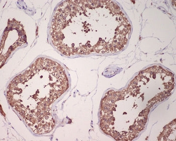 GRP78 Antibody / BiP / HSPA5