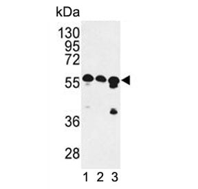 CCR4-NOT transcription complex subunit 4 Antibody / CNOT4