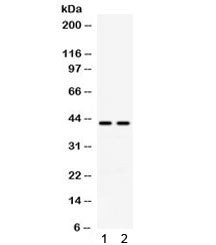Western blot testing of human 1) A549 and 2) COLO320 cell lysate with RAD51C antibody. Expected mole