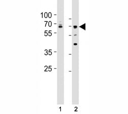 Western blot testing of Lamin A/C antibody at 1:500 dilution. Lane 1: A431 lysate; 2: HepG2 lysate; 