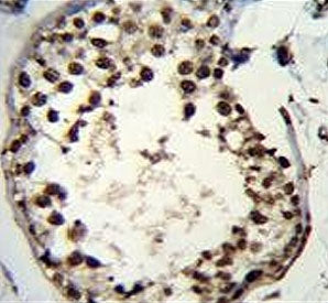 IHC testing of FFPE mouse testis tissue with Additional sex combs-like protein 1 antibody. HIER: ste
