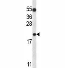 BAX Antibody