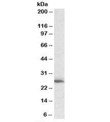 CLPP Antibody