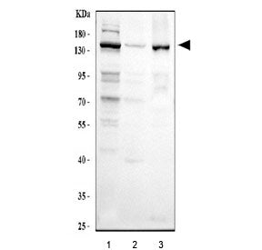 CSB Antibody / Cockayne Syndrome B / ERCC6