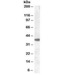 ERCC1 Antibody