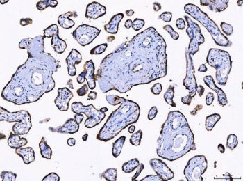 LNPEP Antibody / OTase