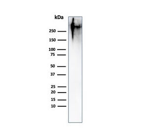 Western blot testing of human MCF7 cell lysate with Epithelial Marker Antigen antibody (clone MUC1/9