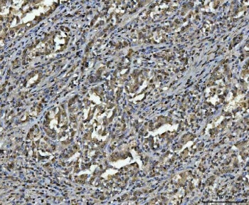 hnRNP U Antibody / HNRNPU