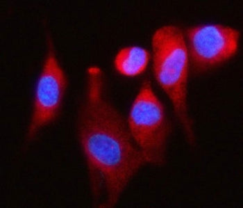 DAP5 Antibody / EIF4G2 / Death-associated protein 5