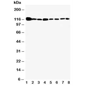 Western blot testing of Vinculin antibody and Lane 1: rat heart; 2: (r) brain; 3: (r) liver; 4: huma