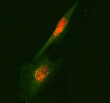 Immunofluorescent staining of FFPE human U-87 MG cells with RUFY2 antibody (red) and Beta Tubulin mA