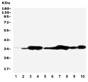 Western blot testing of Annexin V antibody and Lane 1: rat brain; 2: rat skeletal muscle; 3: rat ova