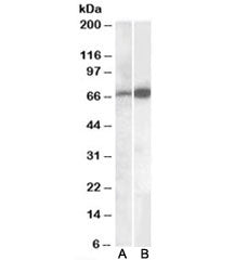 Western blot testing of human cerebellum lysate with CADM4 antibody A) cat # <a href=../tds/cadm4-an