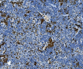 IHC staining of FFPE mouse spleen tissue with Myeloperoxidase antibody. HIER: boil tissue sections i
