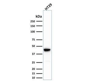 Cytokeratin 20 Antibody / CK20