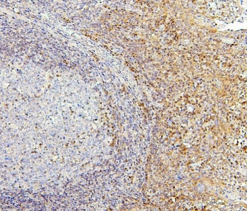 IHC staining of FFPE human tonsil with PPCS antibody. HIER: boil tissue sections in pH6, 10mM citrat