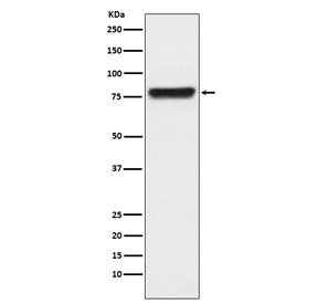 Plasma Kallikrein Antibody / KLKB1
