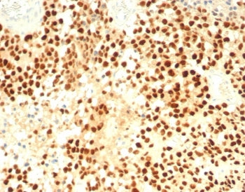 IHC staining of FFPE human adrenal cortex with Steroidogenic Factor 1 antibody (clone SF1/8000R). HI
