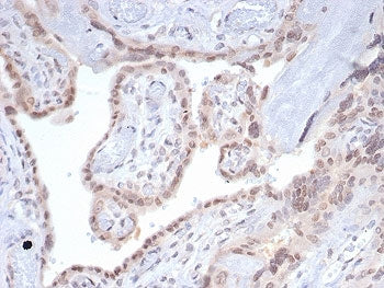 SMAD4 Antibody