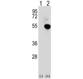 Western blot analysis of IRF4 antibody and 293 cell lysate (2 ug/lane) either nontransfected (Lane 1