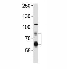 PCSK9 Antibody