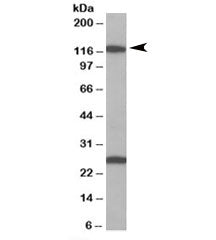 Western blot testing of Daudi lysate with Importin 7 antibody at 1ug/ml. The expected ~120 kDa band 