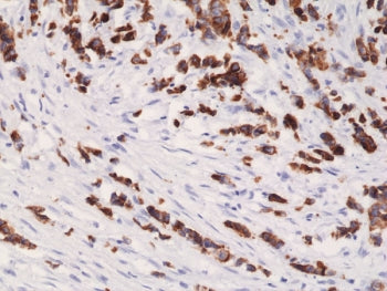 Cytokeratin 19 Antibody / KRT19