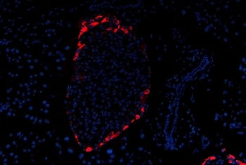 Glucagon Antibody