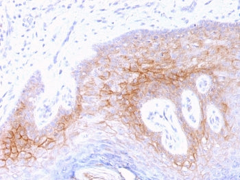 IHC testing of FFPE human skin with Desmocollin 2/3 antibody (clone 7G6). Required HIER: boil tissue