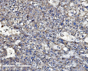 ABCB1 Antibody / P Glycoprotein / MDR1