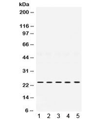 TIMP2 Antibody