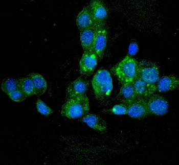 HYI Antibody / Hydroxypyruvate isomerase