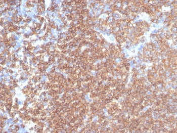IHC staining of FFPE human tonsil tissue with recombinant CD45RA antibody (clone rPTPRC/7284). HIER: