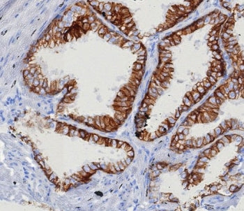 EpCAM Antibody