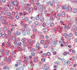 LXN Antibody / Latexin