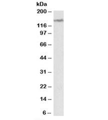 LMTK2 Antibody