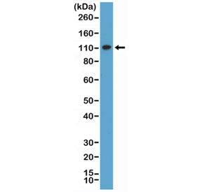 MSH2 Antibody