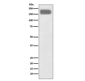 NCAM / CD56 Antibody