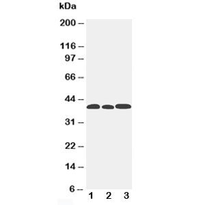 CCR5 Antibody