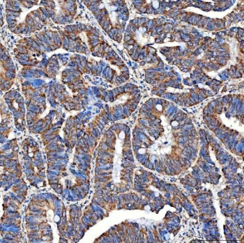 SERAC1 Antibody / Serine active site-containing protein 1