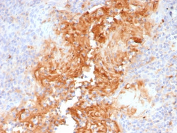 Alpha 1 Antitrypsin Antibody / AAT / SERPINA1