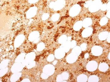 IHC staining of FFPE human bone marrow with recombinant CD71 antibody (clone TFRC/2898R). HIER: boil