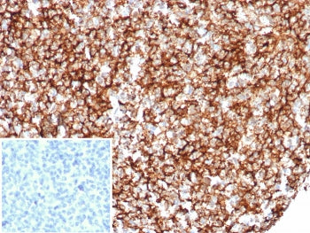CD35 Antibody / CR1