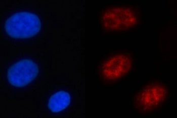 Immunofluorescent staining of FFPE human A549 cells with NFRKB antibody (red) and DAPI nuclear stain