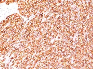 IHC testing of FFPE human tonsil with anti-CD45 antibody (clone SPM570).