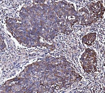 EGF Receptor / EGFR Antibody