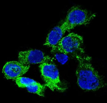 VEGFA Antibody / Vascular Endothelial Growth Factor A